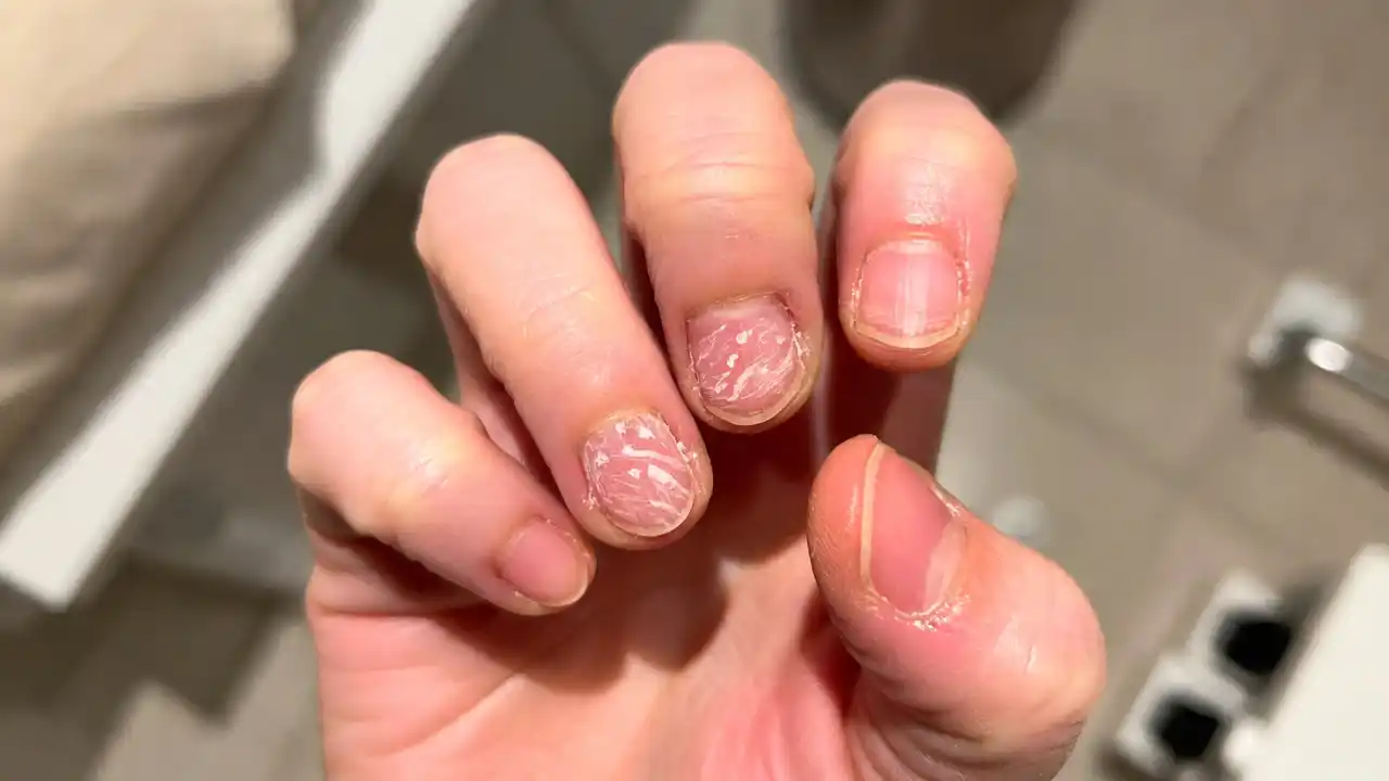 Nail Health and Care